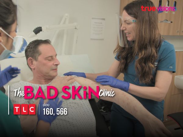The Bad Skin Clinic S4