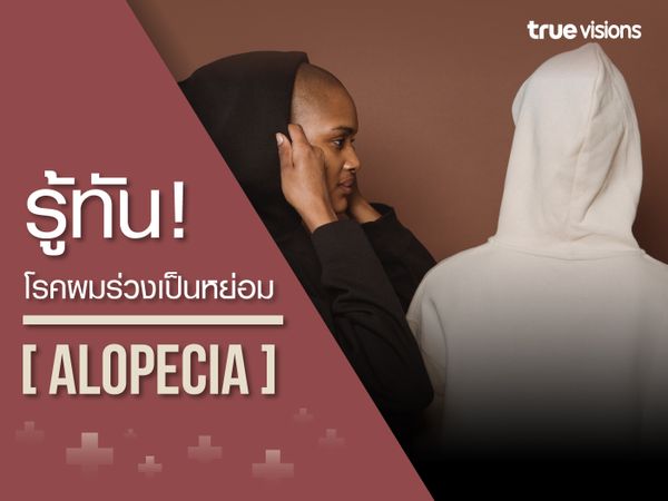 รู้ทันโรคผมร่วงเป็นหย่อม (Alopecia)